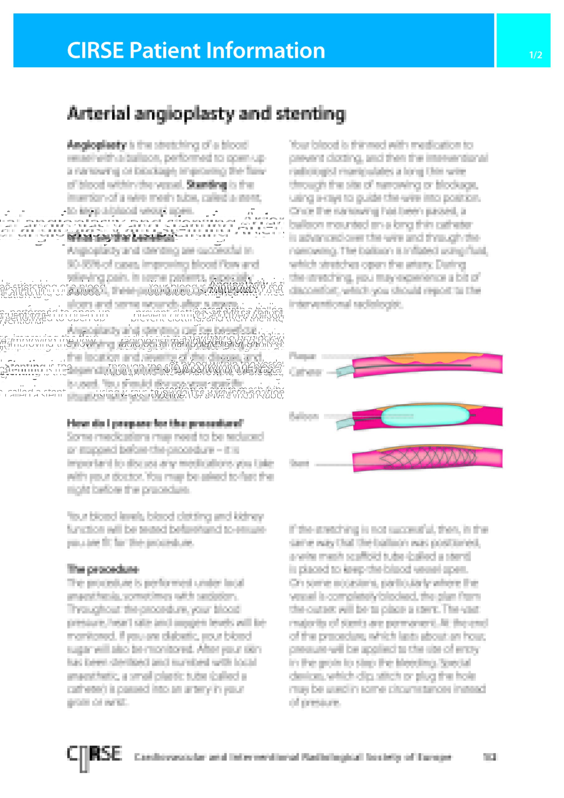 Arterial angioplasty and stenting