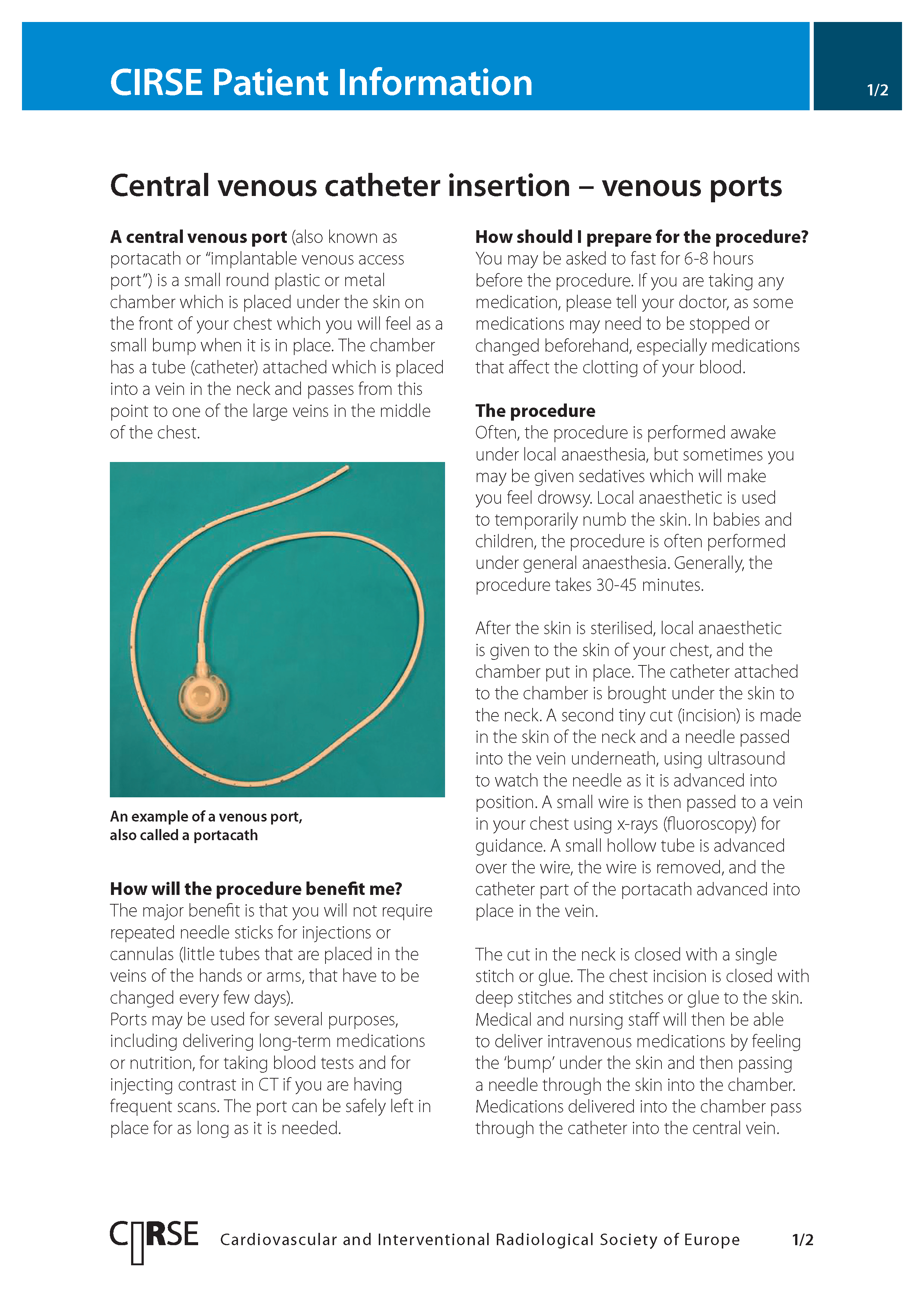 Central venous catheter insertion – venous ports
