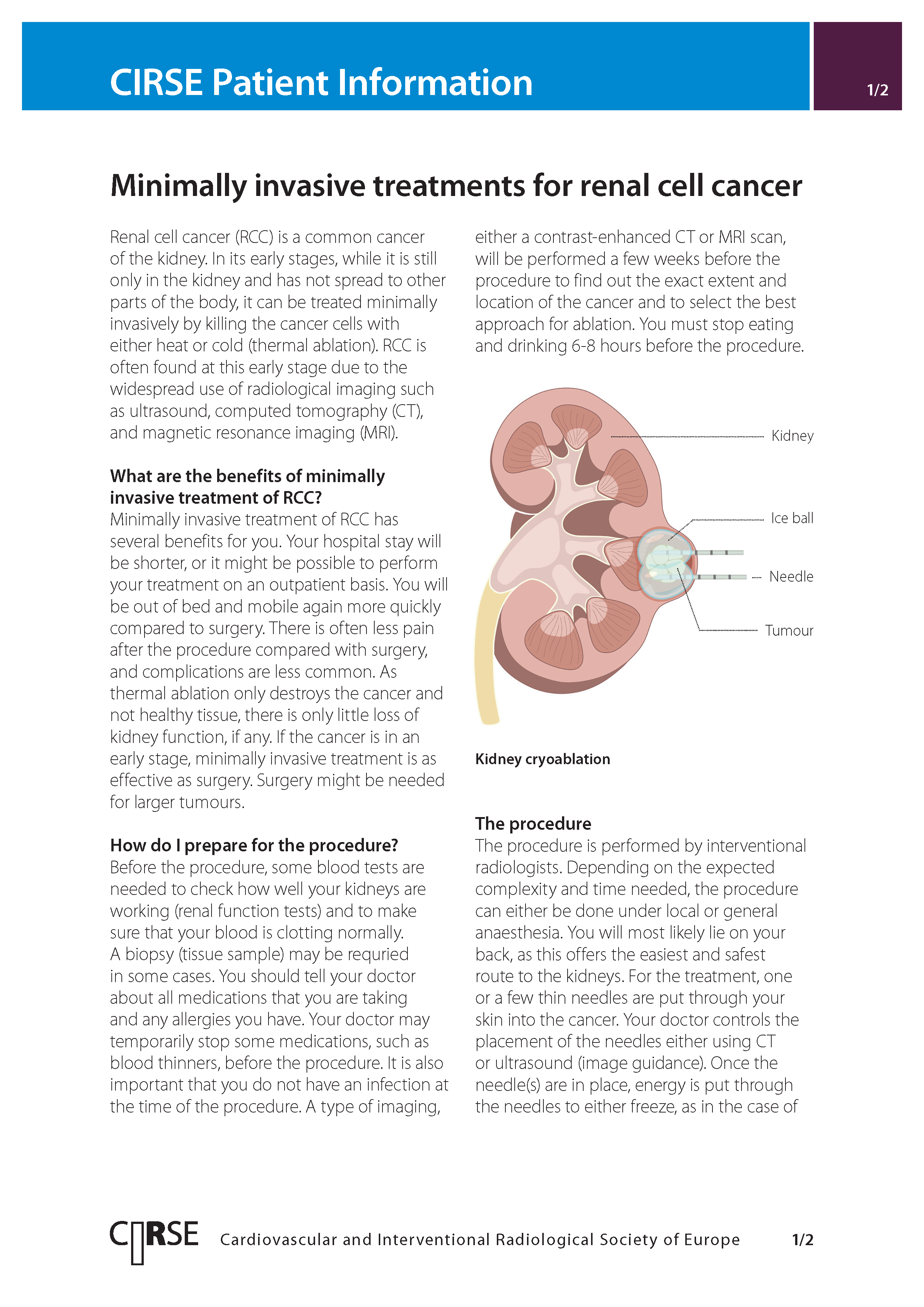 Minimally invasive treatments for renal cell cancer