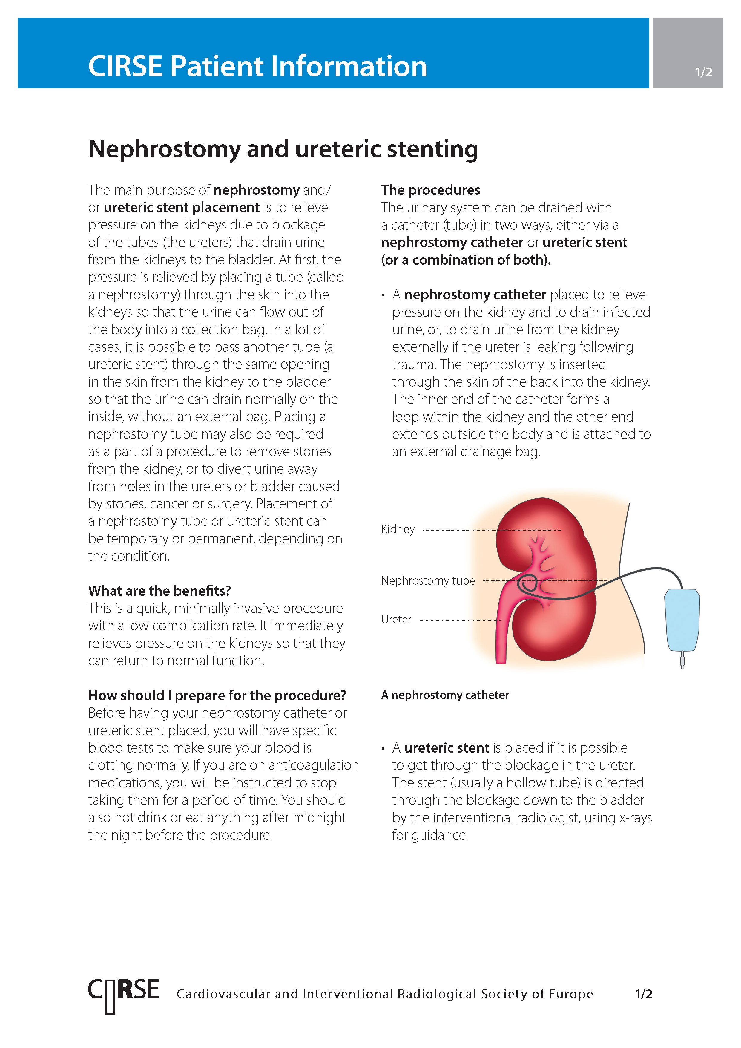 Nephrostomy and ureteric stenting
