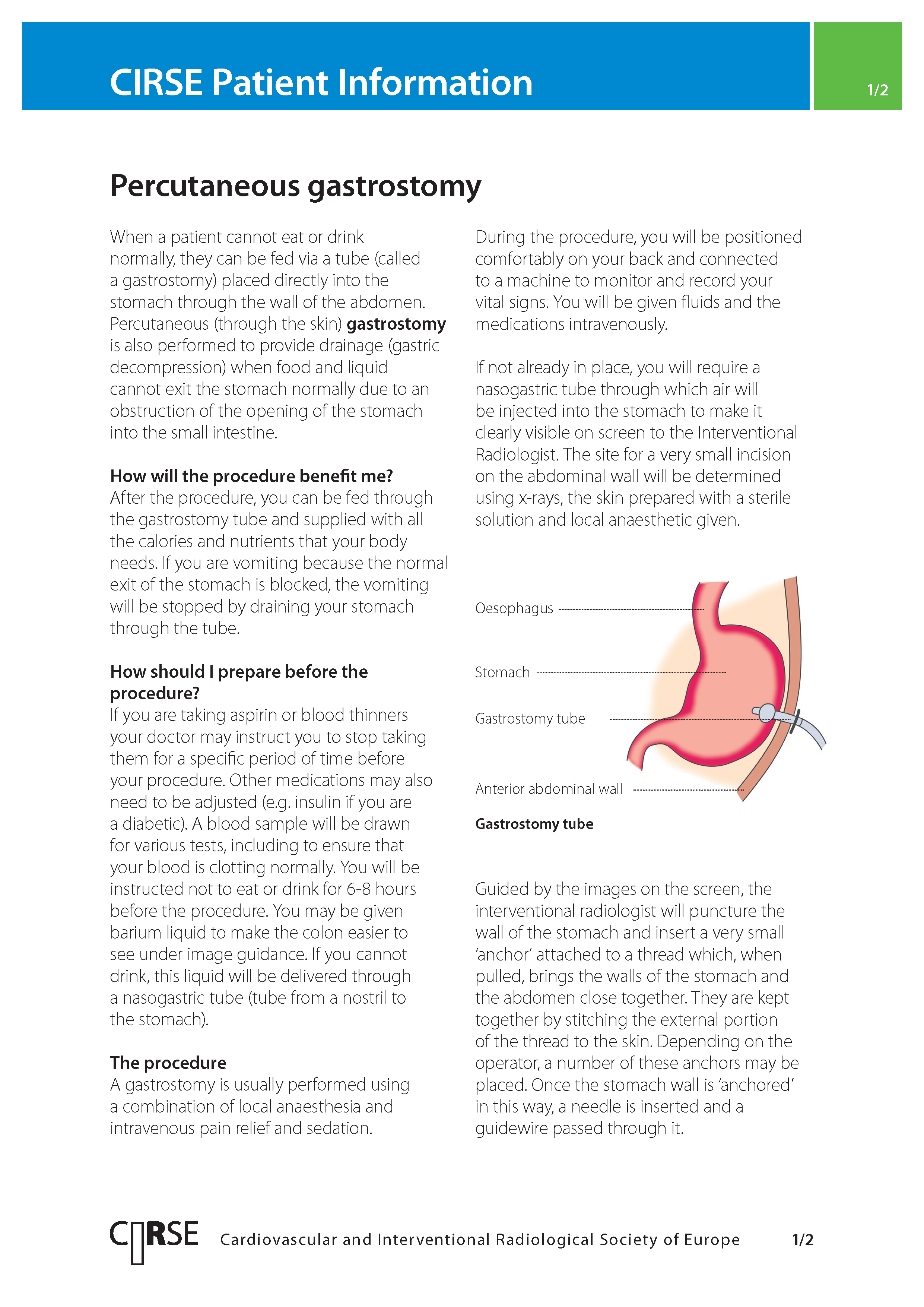 Percutaneous gastrostomy