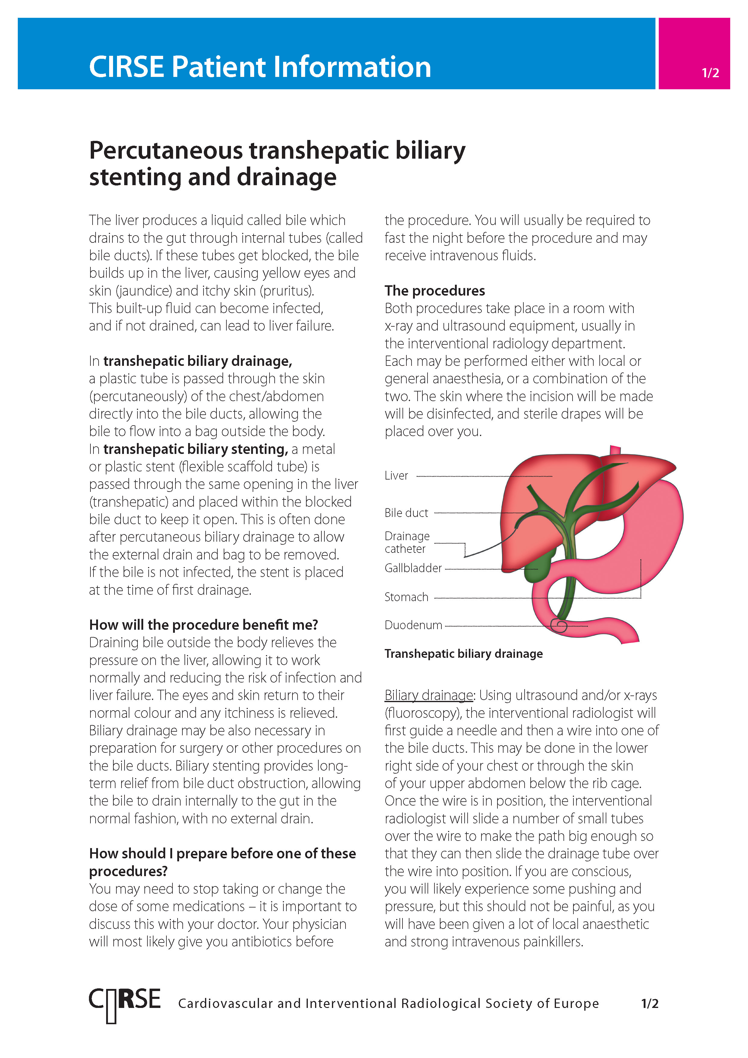 Percutaneous transhepatic biliary stenting and drainage
