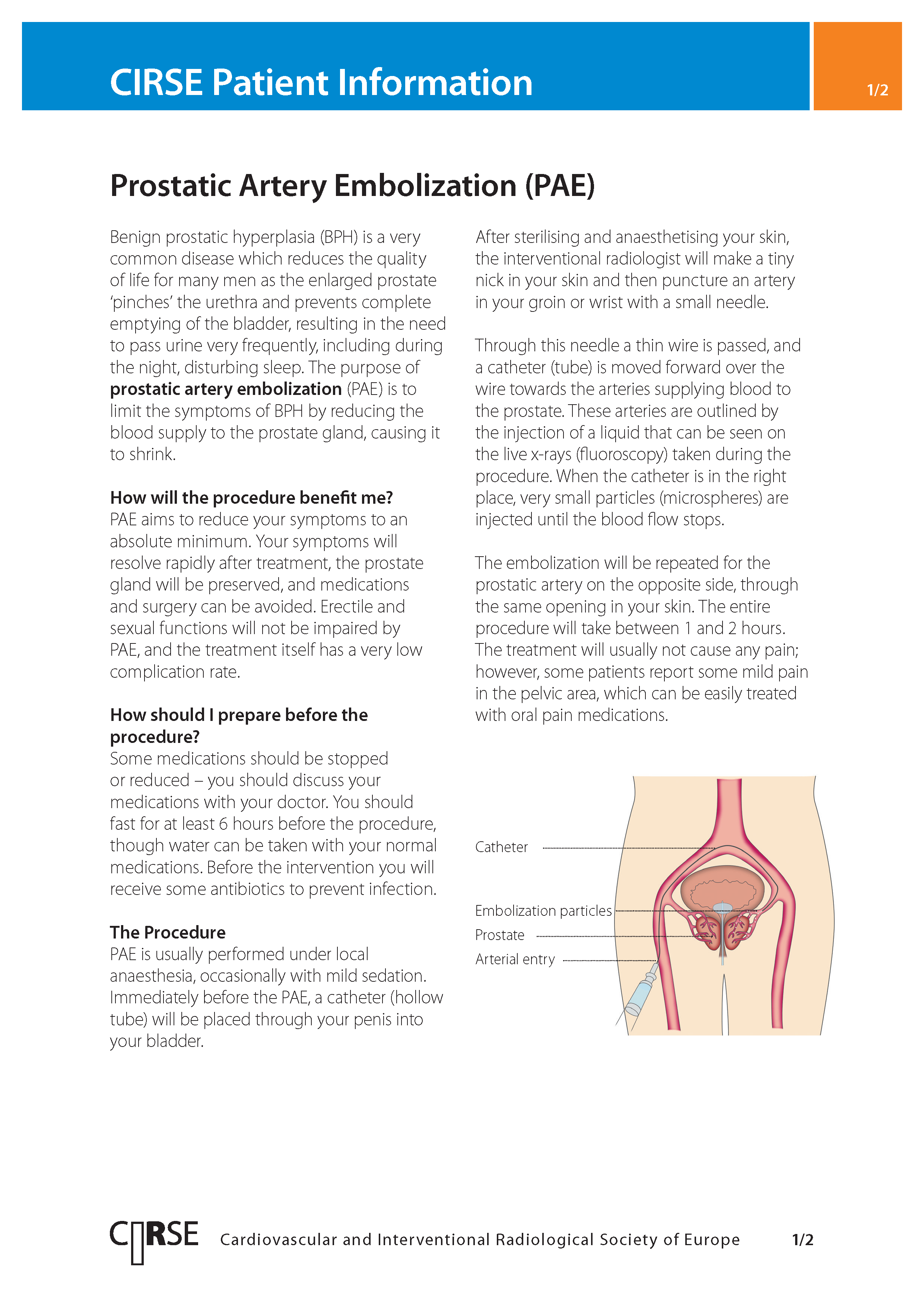 Prostatic artery embolisation (PAE)