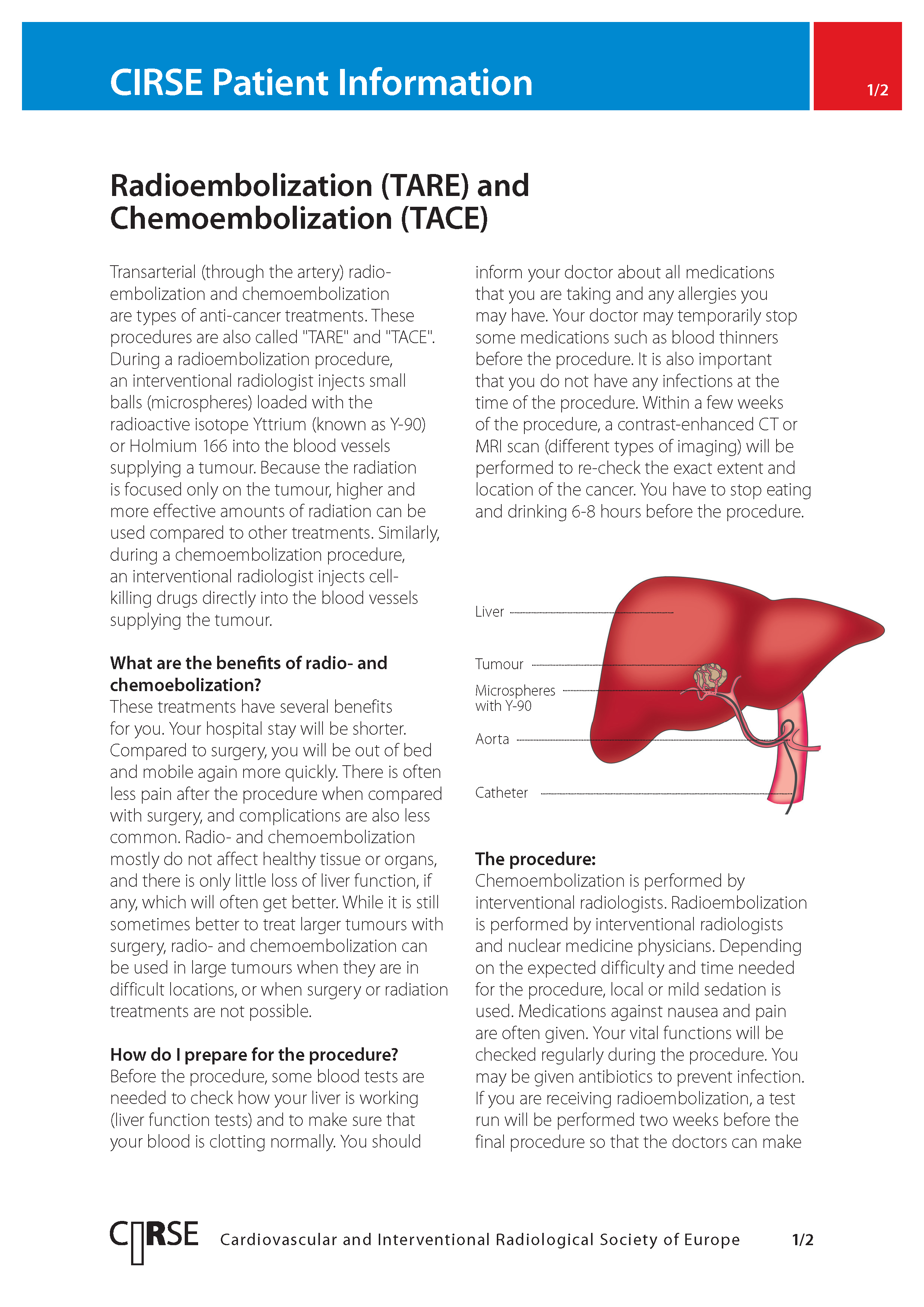 Radioembolization (TARE) and chemoembolization (TACE)